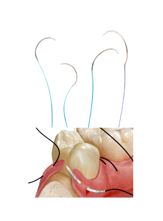 Suturas Dentales